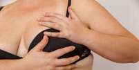 Obesidade é fator de risco para câncer de mama; entenda -  Foto: Shutterstock / Saúde em Dia