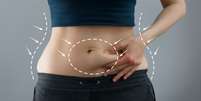 Abdominoplastia: entenda as diferentes finalidades do procedimento -  Foto: Shutterstock / Saúde em Dia