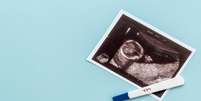 Após fertilização in vitro, mulher deu à luz aos 60 anos; entenda -  Foto: Shutterstock / Saúde em Dia