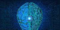AVC: implantes cerebrais podem reduzir sequelas? Entenda -  Foto: Shutterstock / Saúde em Dia