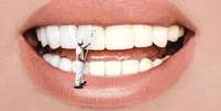 Hábitos que prejudicam os dentes -  Foto: Shutterstock / Saúde em Dia