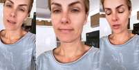 Sem maquiagem e abatida, Ana Hickmann garantiu aos fãs que vai superar o momento difícil na vida privada Foto: Reproduções/Instagram