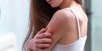 Evite as doenças de pele características do verão - Shutterstock  Foto: Alto Astral