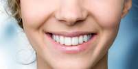 Cuide dos seus dentes com essas dicas de dentistas - Shutterstock  Foto: Alto Astral