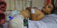 Ahmed Shabat, de 3 anos, perdeu as pernas em uma explosão em Gaza.  Foto: MAHMOUD AKI / BBC News Brasil