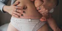 4 dicas para cuidar da pele no pós-parto  Foto: Sou Mais Bem Estar