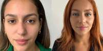 Brasileira viraliza após mudar cor dos olhos: entenda o procedimento  Foto: Reprodução Instagram (@new_color_flaak) / Saúde em Dia