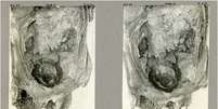 Fotografia de 1908 da dissecação da múmia, mostrando a cabeça do feto ainda dentro da pelve da mãe (Imagem: Margolis, Hunt/International Journal of Osteoarchaeology)  Foto: Canaltech