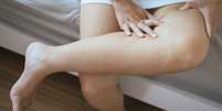 Inchaço nas pernas é uma queixa muito comum no verão  Foto: Shutterstock / Alto Astral