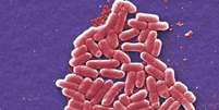 Bactérias estão se tornando mais resistentes nas granjas, como a Escherichia coli (Imagem: Janice Haney Carr/CDC)  Foto: Canaltech