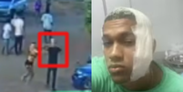Jovem é agredido com uma garrafa de vidro no rosto após tentar separar briga e leva 37 pontos  Foto: Reprodução/TV Bahia