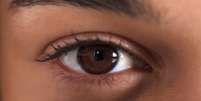 Coçar o olho pode descolar a retina? 10 mitos e verdades sobre a saúde ocular  Foto: Shutterstock / Saúde em Dia