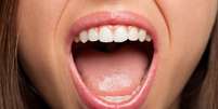 Sintomas que surgem na boca podem indicar diabetes; veja quais  Foto: Shutterstock / Saúde em Dia