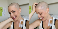 Em tratamento contra leucemia, Fabiana Justus raspa cabelo e compartilha relato emocionante  Foto: Reprodução/Instagram