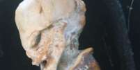 Feto mumificado levanta questões sobre origens humanoides  Foto: Reprodução/X/NazcaMummies