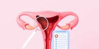 A endometriose afeta uma em cada dez mulher no Brasil  Foto: Tina Ji | Shutterstock / Portal EdiCase