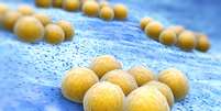 Estafilococo aureus (Staphylococcus aureus resistente à meticilina)  Foto: iStock