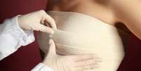 Mastopexia e mamoplastia sem silicone: entenda como são as cirurgias  Foto: Shutterstock / Saúde em Dia