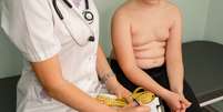 Problema de obesidade infantil. Garoto gordo em uma consulta médica  Foto: ELENA BESSONOVA/iStock
