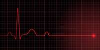 Parada cardíaca: o que é, causas e consequências  Foto: Shutterstock / Saúde em Dia