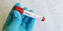 Exame que detecta dengue  Foto: jarun011/iStock