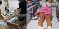 Os influenciadores precisaram ir ao hospital; um permanece internado  Foto: Reprodu&ccedil;&atilde;o/Instagram