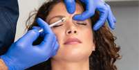 Descubra os benefícios do botox além da estética  Foto: Shutterstock / Alto Astral