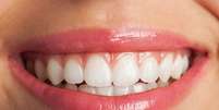 Saiba o que fazer para manter os resultados do clareamento dental |  Foto: asierromero/Freepik / Boa Forma