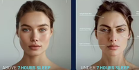 IA mostra impacto no rosto de pessoas que dormem menos de 7 horas por noite   Foto: 
