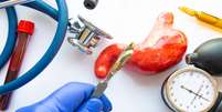 Bariátrica: o que você precisa fazer antes da cirurgia  Foto: Shutterstock / Saúde em Dia
