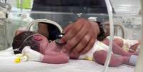 A mãe, Sabreen, não pôde ser salva, mas os médicos trabalharam para ressuscitar a bebê  Foto: Reuters / BBC News Brasil