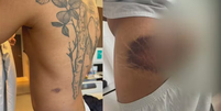 Imagens mostram os hematomas de Danilo, que ficou 6 dias internado  Foto: Reprodução/TV Globo