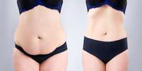 Emagrecimento: 8 dicas para eliminar gordura corporal  Foto: Shutterstock / Saúde em Dia