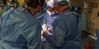Primeiro transplante de rim de porco em uma pessoa viva —  Foto: Massachussets General Hospital / Perfil Brasil