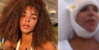 Antes e depois de Brunna Gonçalves: veja como esposa de Ludmilla ficou após diminuir a testa.  Foto: Instagram / Purepeople