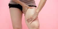 Suplementos podem tratar lipedema? Entenda  Foto: Shutterstock / Saúde em Dia