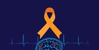 A esclerose múltipla é uma doença neurológica crônica  Foto: MURGROUP || Shutterstock / Portal EdiCase