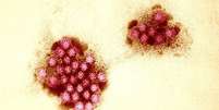 As proteínas que compõem o revestimento externo do norovírus agem como uma espécie de armadura  Foto: Getty Images / BBC News Brasil