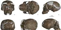 O crânio do Homem de Yunxian II, como reconstruído pelos cientistas para o estudo (Imagem: Feng et al./bioRxiv) Foto: Canaltech