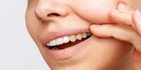A cor natural dos dentes é influenciada por vários fatores  Foto: iStock