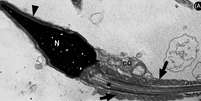 Espermatozoide infectado por covid-19, como mostrado em imagem de microscopia eletrônica (Imagem: Hallak et al./Andrology)  Foto: Canaltech