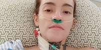 Carolina Arruda foi diagnosticada com neuralgia do trigêmeo, doença conhecida por causar 'a pior dor do mundo'  Foto: Arquivo pessoal / BBC News Brasil