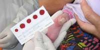 A pesquisa utilizou a mesma gota de sangue no papel filtro coletada para a triagem neonatal, chamada de teste do pezinho. Os bebês não passam por nenhum procedimento diferente do habitual.  Foto: Divulgação/Nupad/Faculdade de Medicina da UFMG / Estadão