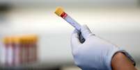 Em uma amostra do sangue, os biomarcadores podem representar uma fotografia do estado bioqu&iacute;mico atual do seu corpo  Foto: PA / BBC News Brasil
