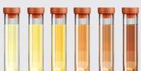 A urina pode assumir diferentes cores e tonalidades  Foto: Getty Images / BBC News Brasil