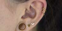 Alargador de orelha pode causar deformidades permanentes que exigem intervenção cirúrgica  Foto: Shutterstock / Alto Astral