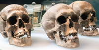Três crânios e cérebros humanos (em segundo plano) foram encontrados em Cornaux/Les Sauges.  Foto: Laténium/Romain Do