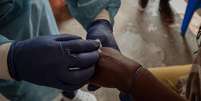 Ainda há muito a ser aprendido sobre a nova variante da mpox que pode estar se espalhando mais facilmente e causando doenças mais graves, dizem especialistas  Foto: Getty Images / BBC News Brasil