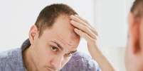 Minoxidil causa impotência / Foto: Shutterstock  Foto: Saúde em Dia
