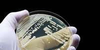 Candida auris é resistente às medicações usadas para combater fungos do mesmo gênero  Foto: TopMicrobialStock